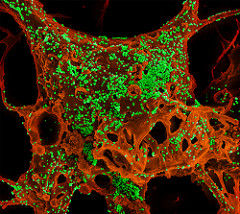 MERS Coronavirus Particles　photo:NIAID　CC BY 2.0（Flickr)